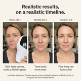 Realistic results on a realistic timeline: weeks 1 to 4 skin feels calmer, months 2 to 3 tone looks more even, months 4 to 6 fine lines can look softer. Individual results vary.